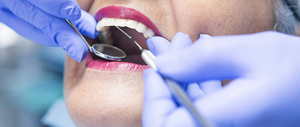 Best Dental Abscess Treatment in Garden City, MI